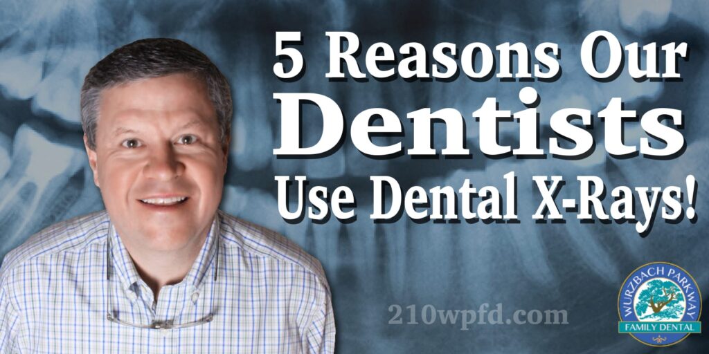 5 reasons our dentists use dental x-rays!